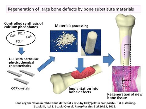  Osteoconductive Properties and Applications of Orthopedic-Grade Osseointegration Composites!